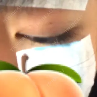 2日目の経過画像（2枚目）