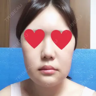 12日目の経過画像（1枚目）