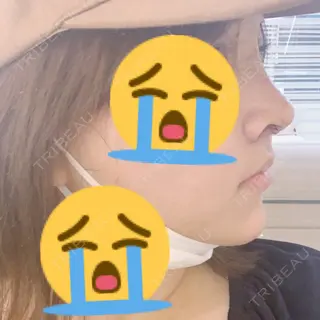 6日目の経過画像（1枚目）