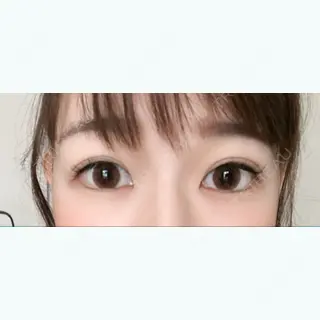 48日目の経過画像（1枚目）