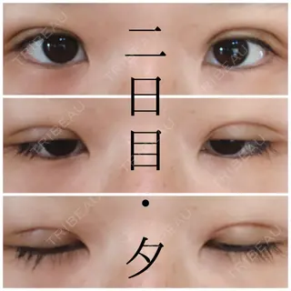 2日目の経過画像（2枚目）