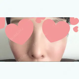 10日目の経過画像（1枚目）