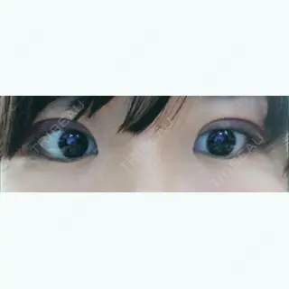 1日目の経過画像（3枚目）