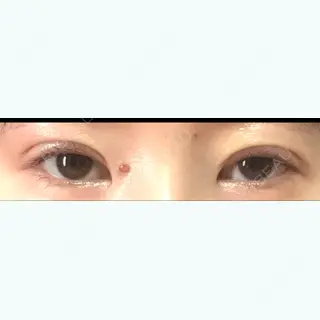 10日目の経過画像（1枚目）