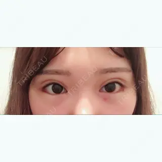 9日目の経過画像（1枚目）