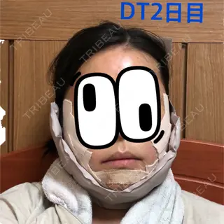 2日目の経過画像（1枚目）
