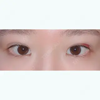 1日目の経過画像（3枚目）