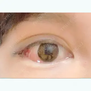 4日目の経過画像（3枚目）