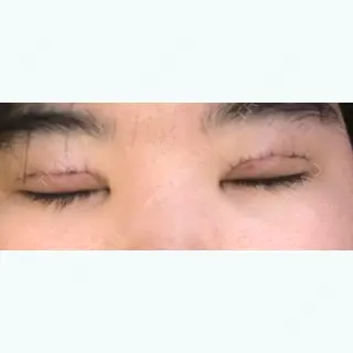 2日目の経過画像（2枚目）