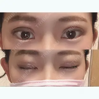 7日目の経過画像（1枚目）