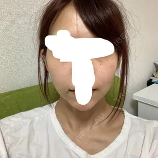 19日目の経過画像（1枚目）