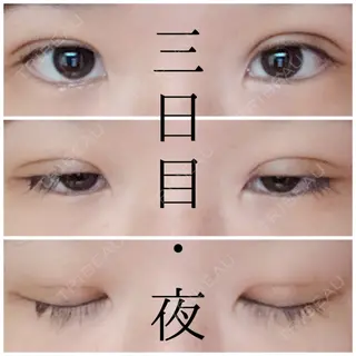 3日目の経過画像（3枚目）