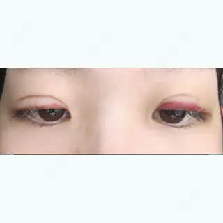 7日目の経過画像（2枚目）