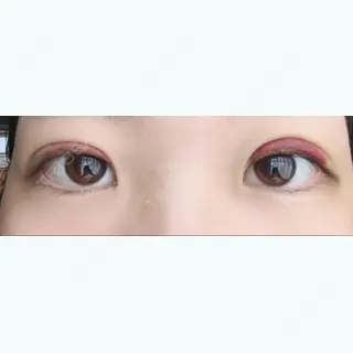 7日目の経過画像（3枚目）