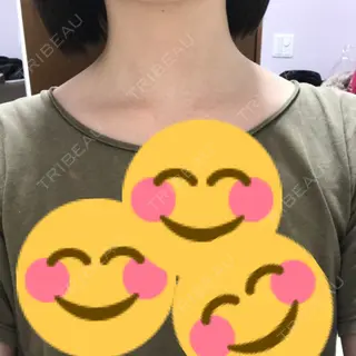 30日目の経過画像（1枚目）