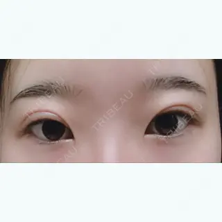 1日目の経過画像（1枚目）