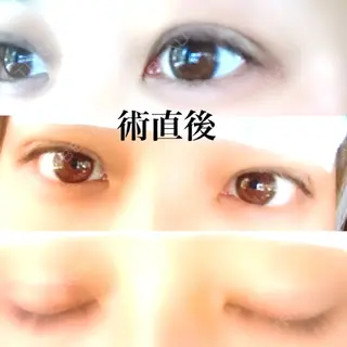 0日目の経過画像（1枚目）