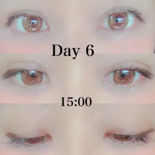 5日目の経過画像（2枚目）