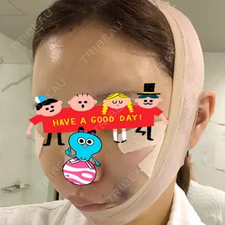 5日目の経過画像（2枚目）