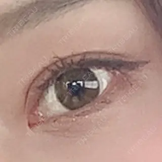 8日目の経過画像（1枚目）