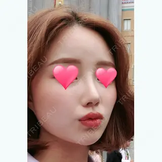 150日目の経過画像（1枚目）