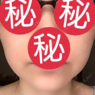 1日目の経過画像（1枚目）