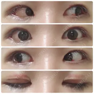 7日目の経過画像（1枚目）