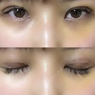 6日目の経過画像（1枚目）