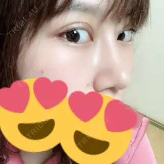 23日目の経過画像（2枚目）