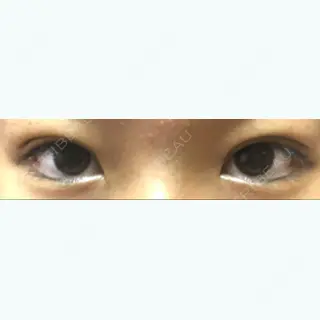 4日目の経過画像（1枚目）