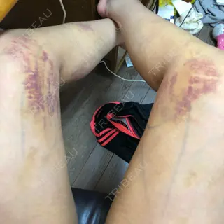 9日目の経過画像（1枚目）