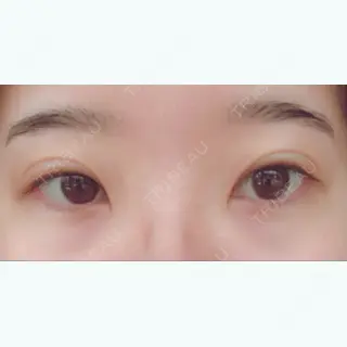 9日目の経過画像（1枚目）