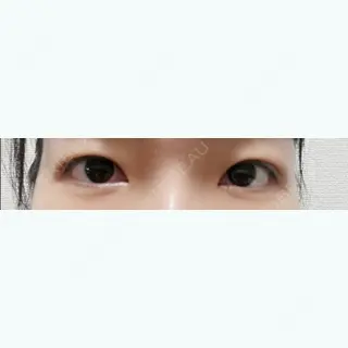 7日目の経過画像（1枚目）