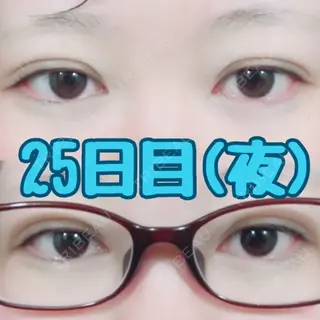 27日目の経過画像（1枚目）