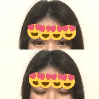 10日目の経過画像（1枚目）