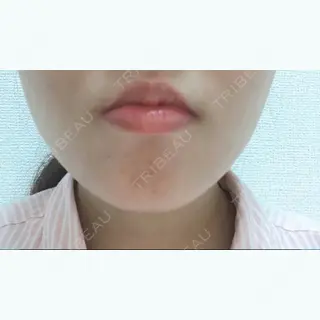 1日目の経過画像（1枚目）