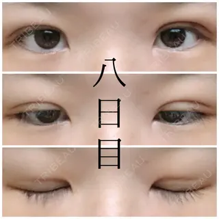 8日目の経過画像（1枚目）