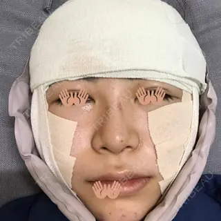 0日目の経過画像（1枚目）