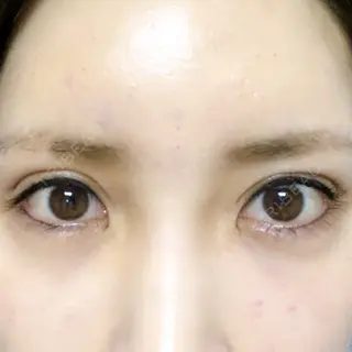 1日目の経過画像（1枚目）
