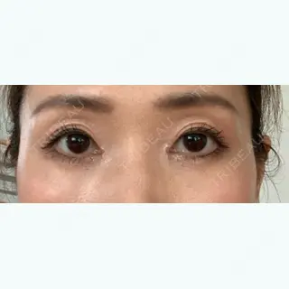 10日目の経過画像（1枚目）