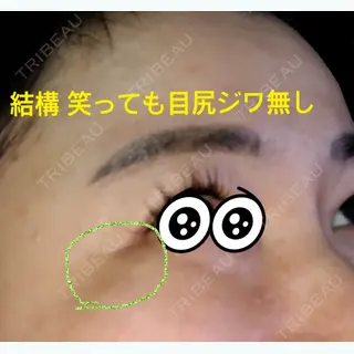 58日目の経過画像（1枚目）