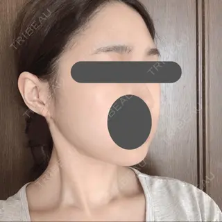 12日目の経過画像（3枚目）