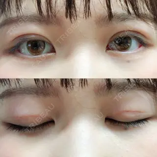 9日目の経過画像（1枚目）