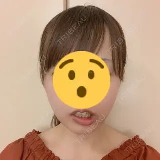 26日目の経過画像（1枚目）