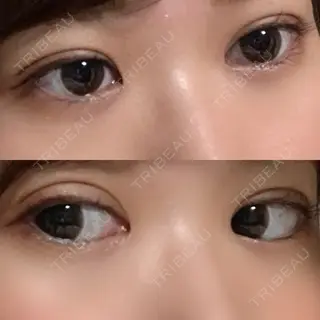 9日目の経過画像（1枚目）