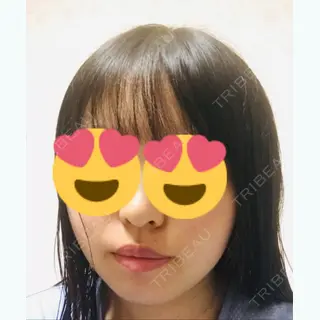 26日目の経過画像（1枚目）