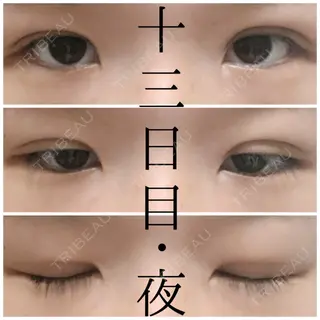 13日目の経過画像（2枚目）