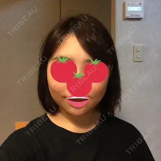 3日目の経過画像（1枚目）