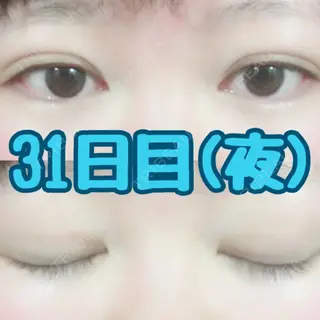 31日目の経過画像（1枚目）