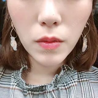 25日目の経過画像（1枚目）